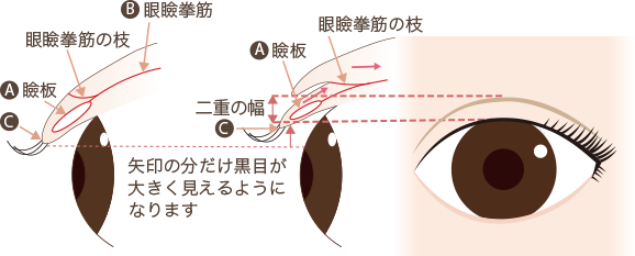 二重まぶたの構造