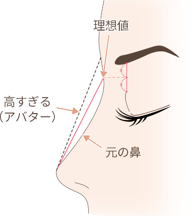 鼻の整形 施術一覧 大阪院 梅田 美容整形 美容外科なら水の森美容外科 公式