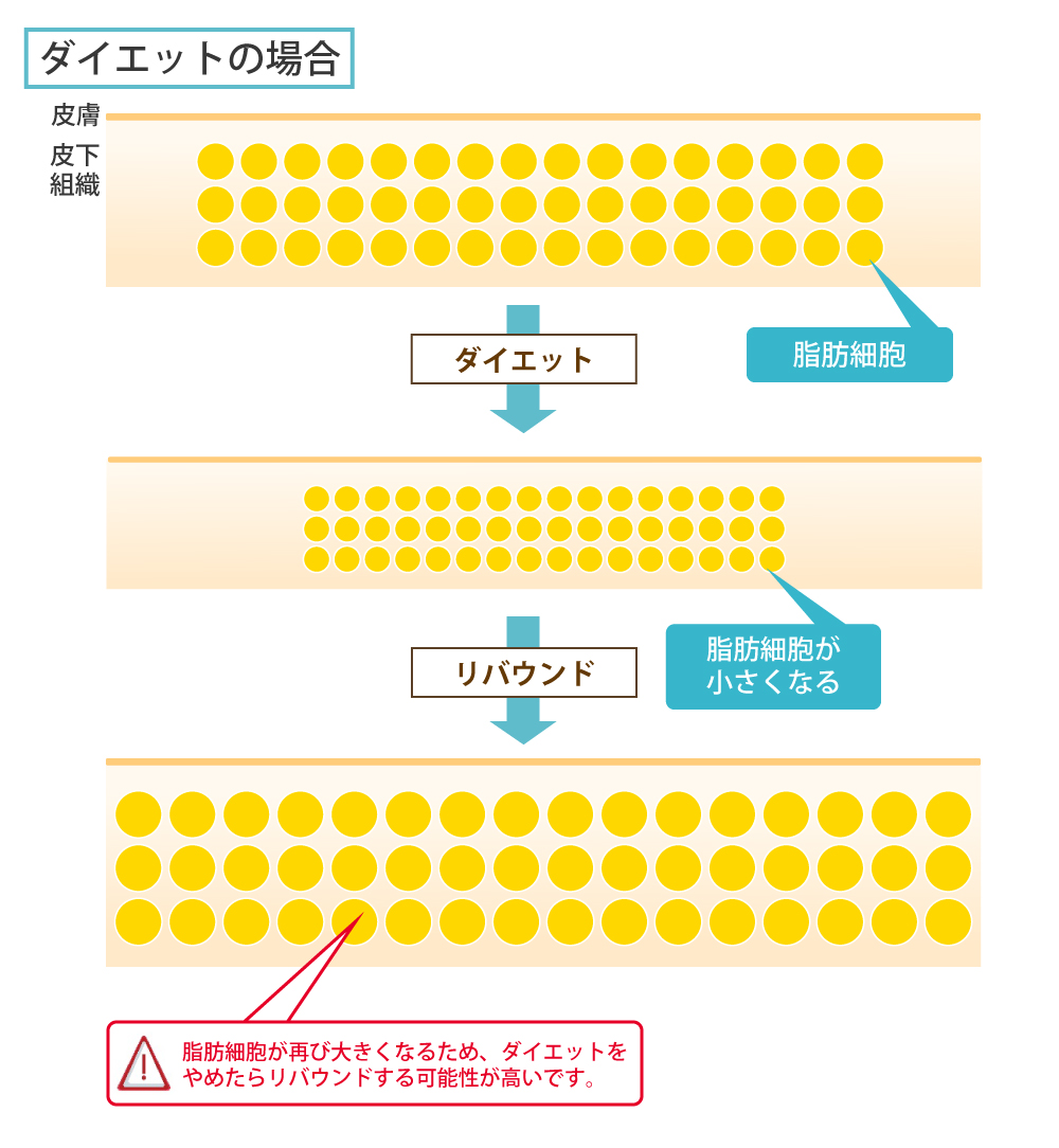 脂肪吸引 顔 太腿 お尻 二の腕 お腹 ウエスト の美容整形について 大阪院 梅田 美容整形 美容外科なら水の森美容外科 公式