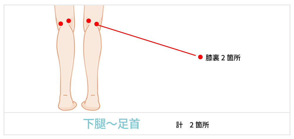 脂肪吸引で傷が出来る箇所の説明 足