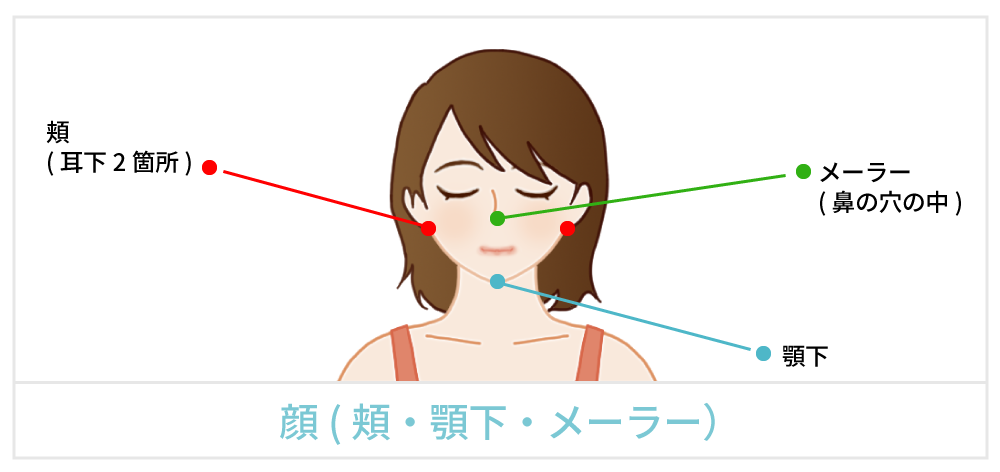 脂肪吸引で傷が出来る箇所の説明 顔