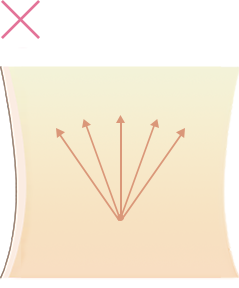 脂肪吸引 顔 太腿 お尻 二の腕 お腹 ウエスト の美容整形について 大阪院 梅田 美容整形 美容外科なら水の森美容外科 公式