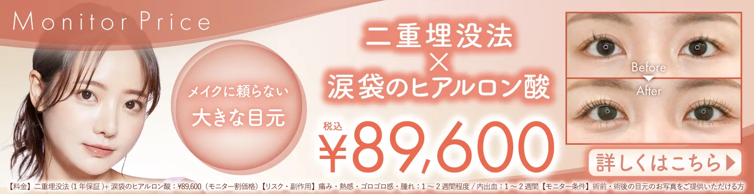 期間限定:二重埋没法×涙袋のヒアルロン酸注入　セット割引