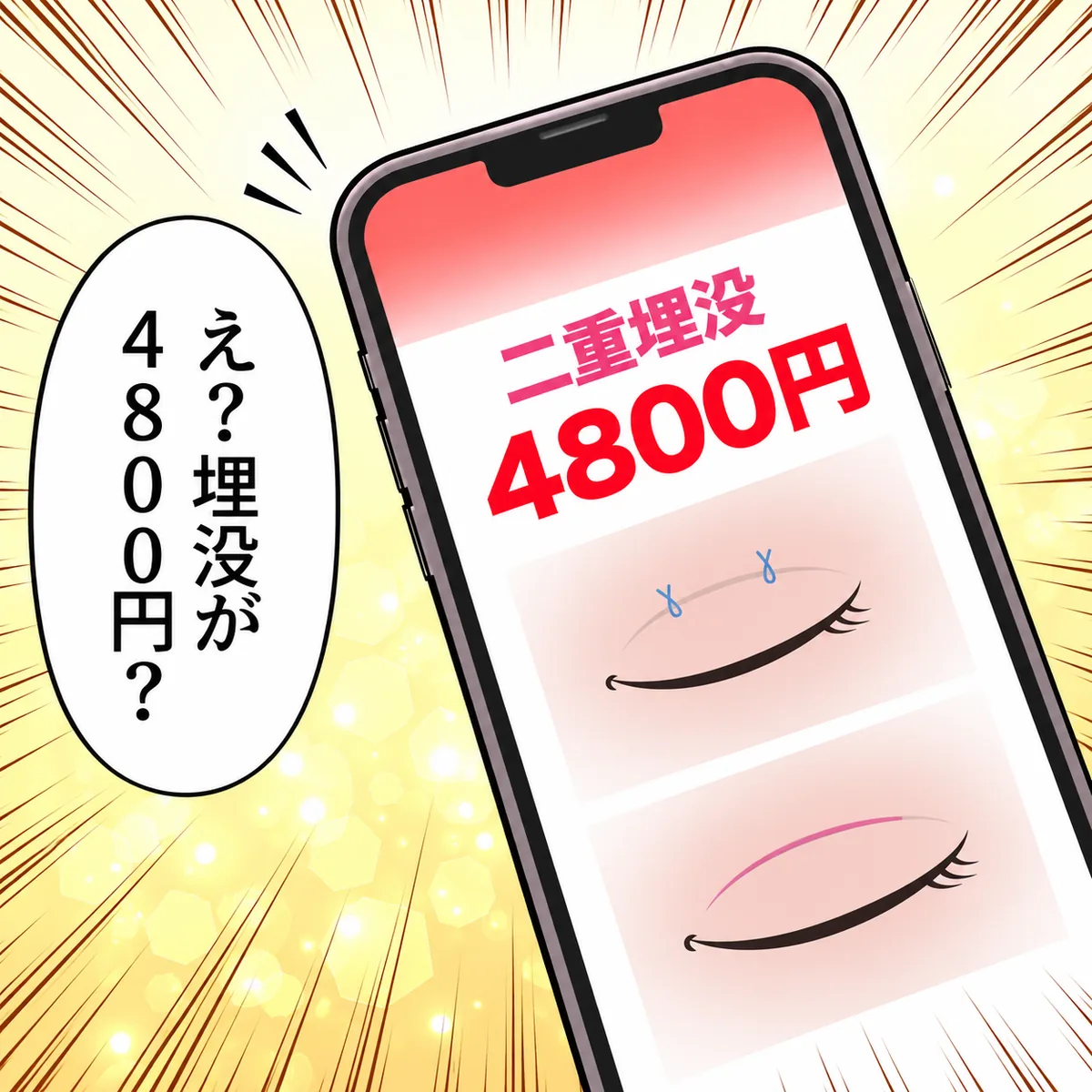 え?埋没が4800円?