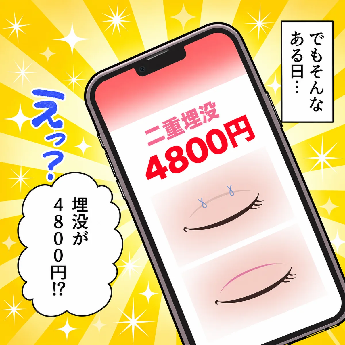 でもそんなある日…えっ?埋没が4800円!?
